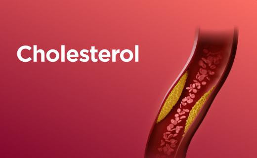 Cholesterol