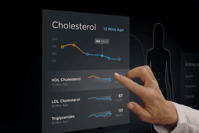 A hand manipulates a screen that is displaying a graph of a patient's cholesterol levels over time.