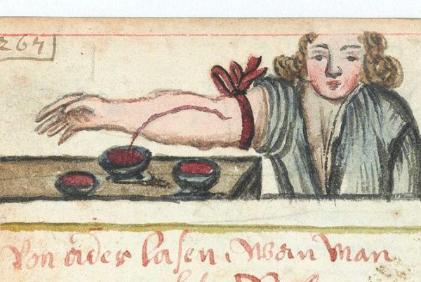 old drawing of blood letting on parchment